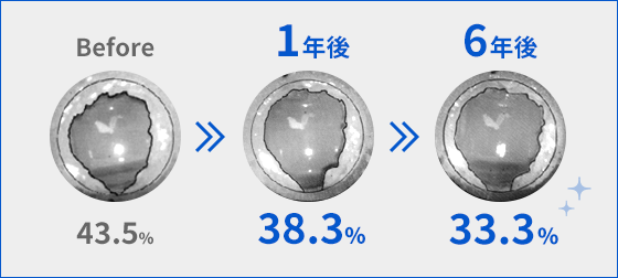 マンション給水配管（異種金属接合部）｜配管内の赤錆閉塞率の改善