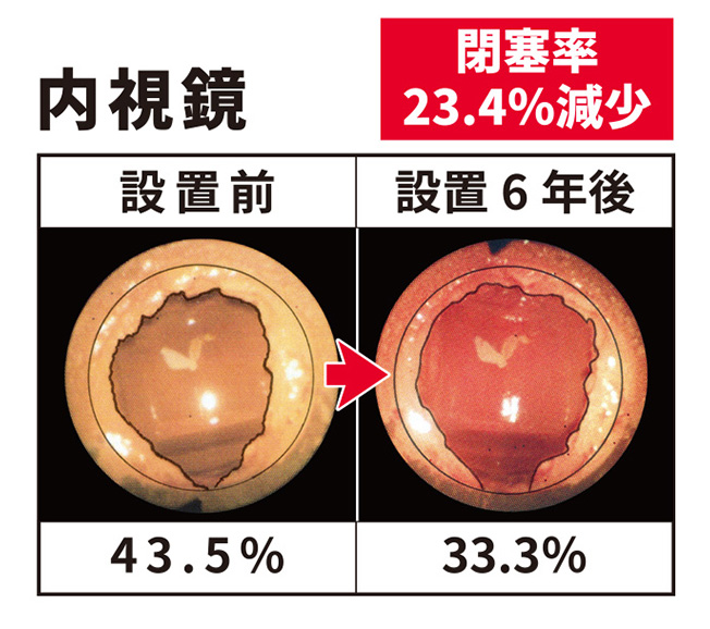 内視鏡調査